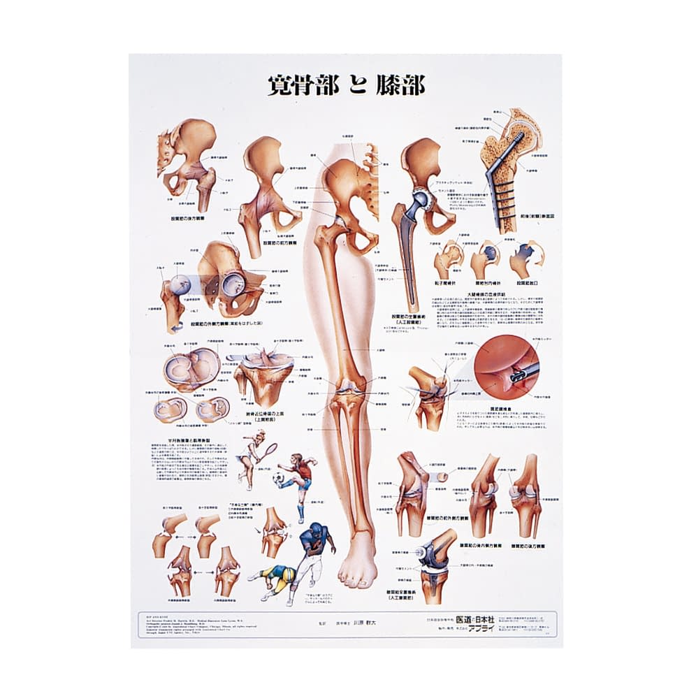 人体解剖学チャート(ポスターサイズ) ポスターサイズ・ラミネート版 11-2230-0015 寛骨部と膝部S アプライ ラミネートバン