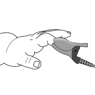 乳幼児用フィンガークリッププローブ 23-2314-06 ユビックス IPFP-181-60(60CM)