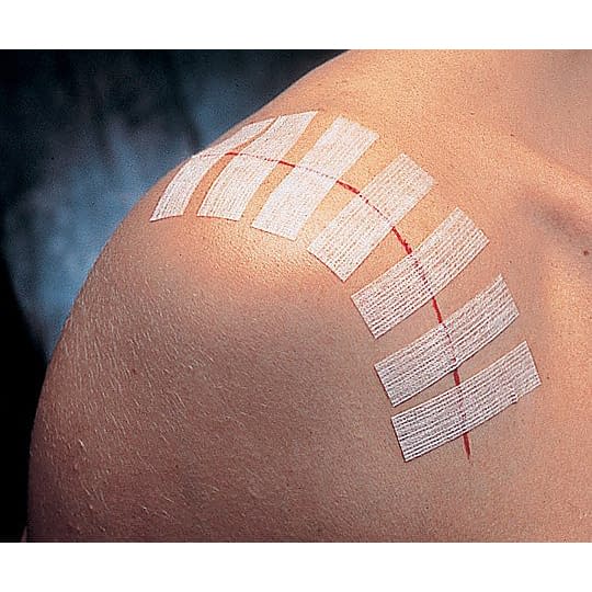 ステリストリップスタンダード 皮膚接合用テープ 24-9498-00 スリーエムジャパン R1540(3X75)5ホンX50フクロ