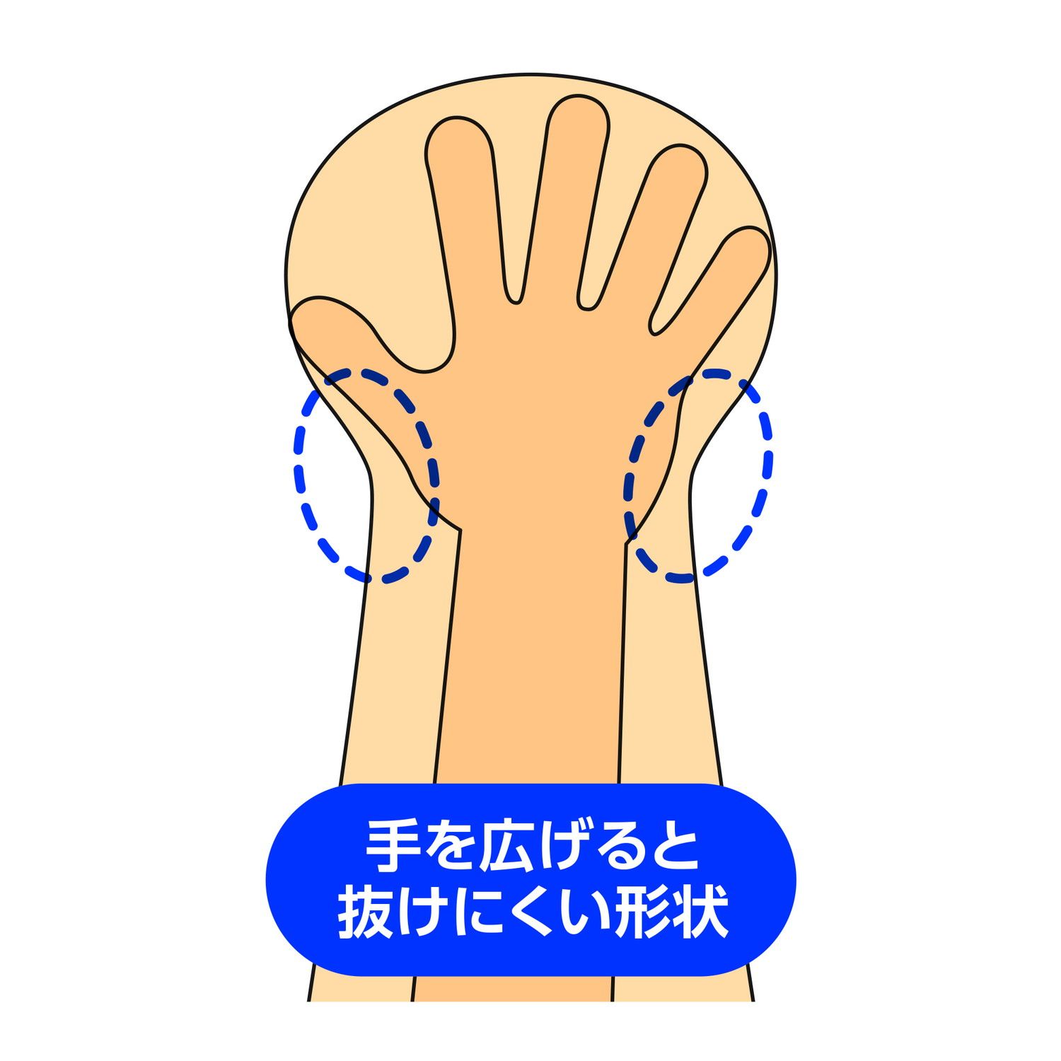 使い捨て体圧除圧グローブ プラスハート 75173(ベージュ)100マイイリ 使い捨て体圧除圧グローブ プラスハート 75173(ベージュ)100マイイリ